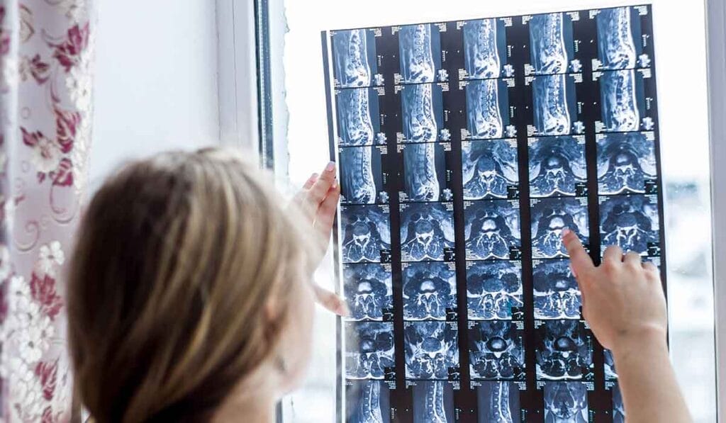 Persona examina imágenes de rayos X frente a una ventana, con detalles visibles de exploraciones de la columna y la cabeza.